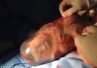 VIDEÓ: burokban született meg a baba! VIDEÓ: burokban született meg a baba!