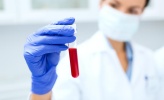 Életmentő őssejtek: látogatóban a Krio Intézetnél Életmentő őssejtek: látogatóban a Krio Intézetnél