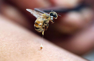 méhcsípés a szem elől a legjobb termékek a látáshoz